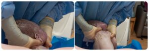 Birth Photography an unassisted birth at Avista Hospital Lafayette Baby Boy Rhys