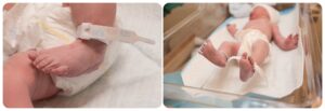 Birth Photography an unassisted birth at Avista Hospital Lafayette Baby Boy Rhys